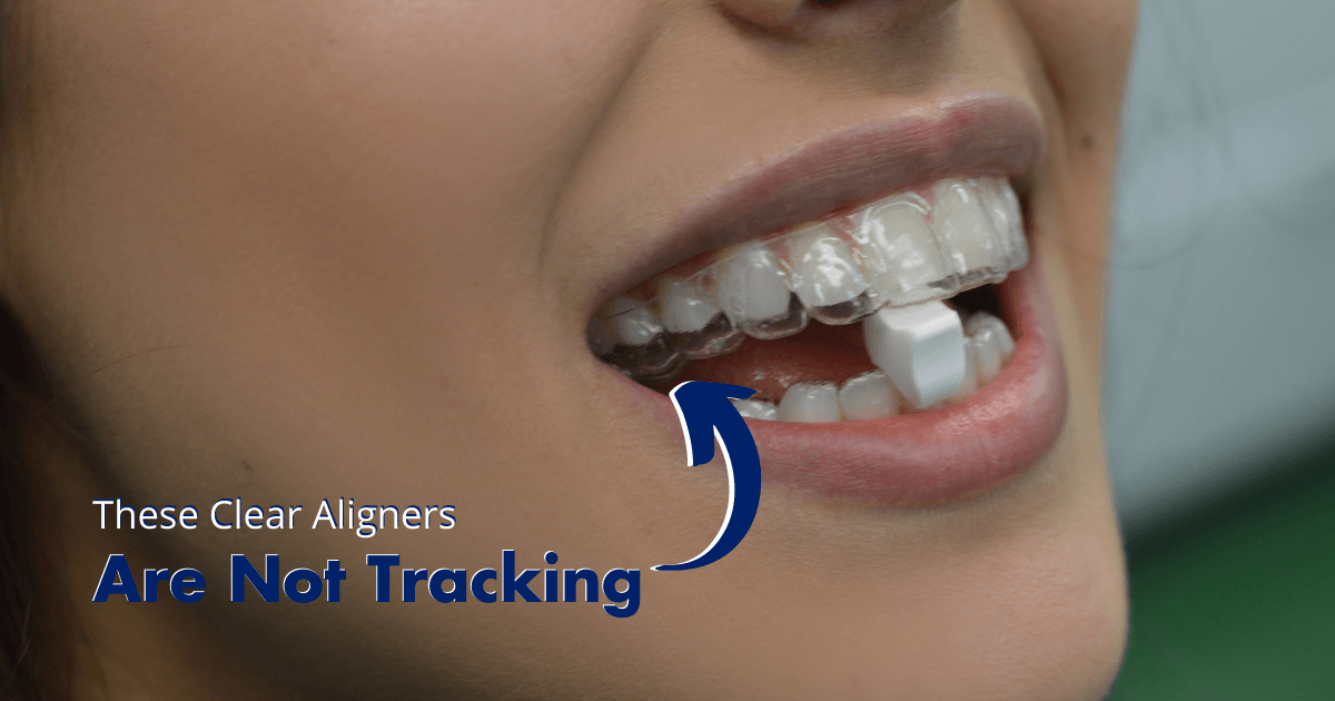 http://www.dentalmovemints.com/cdn/shop/articles/Is_Your_Invisalign_Not_Tracking_Try_This_featured_image.png?v=1653332043