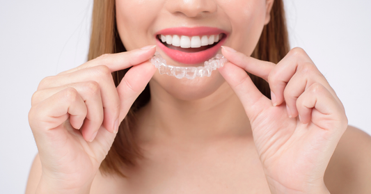 Image of invisalign attachments, a part of the Invisalign system.