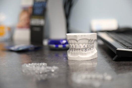 4 Ways Clear Aligners Win over Traditional Braces
