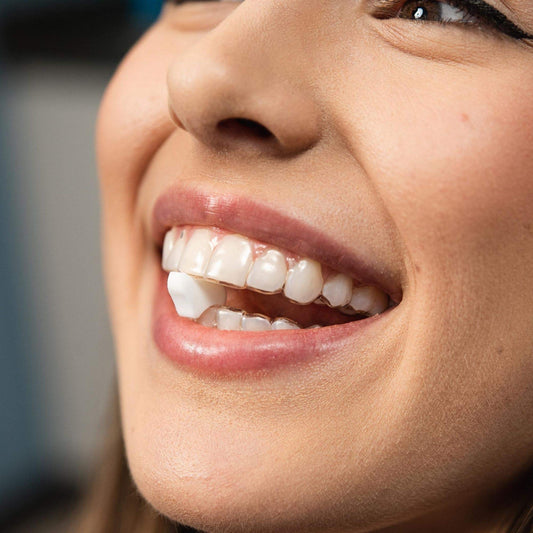Can You Have Mints with Invisalign? The Ultimate Guide to Invisalign-Friendly Mints