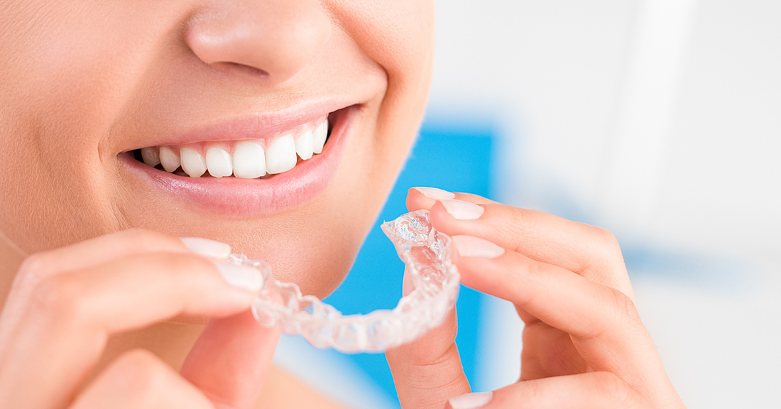 Picture of a person smiling with a straighter smile after using removable aligners.