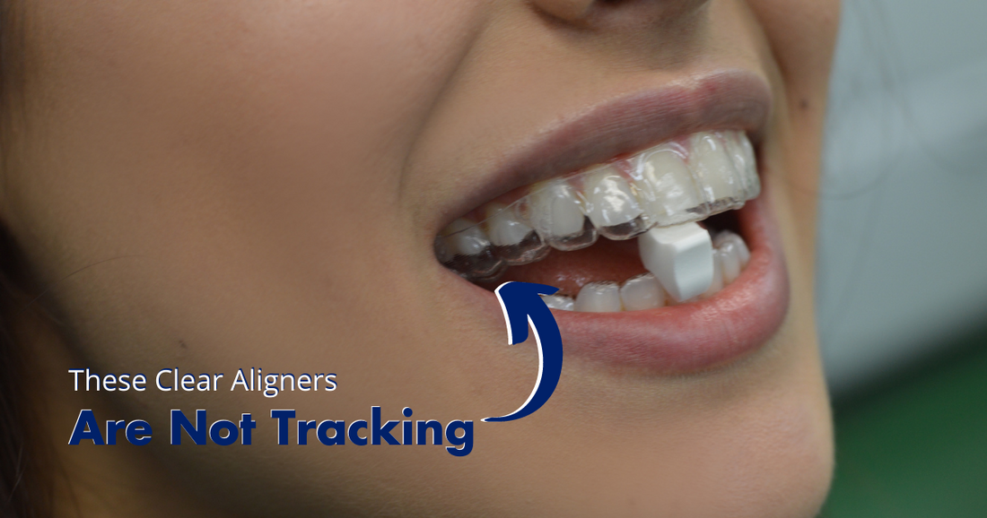What are Invisalign attachments and why you might need one?