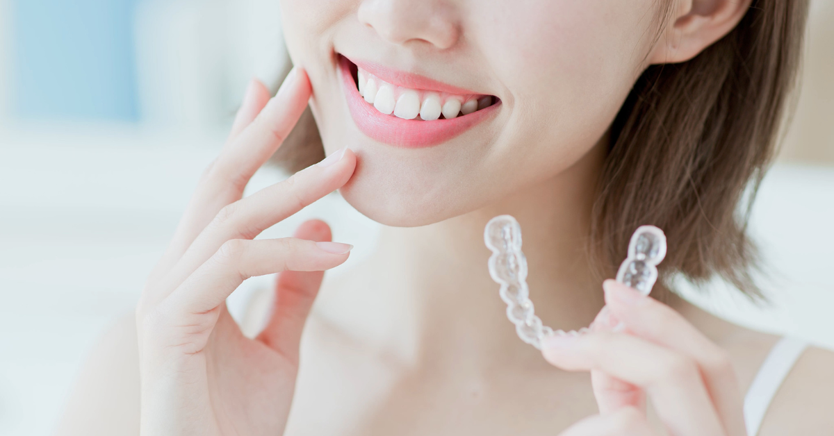 Movemint Invisalign Invisalign Timeline: The Complete Guide by Movemints